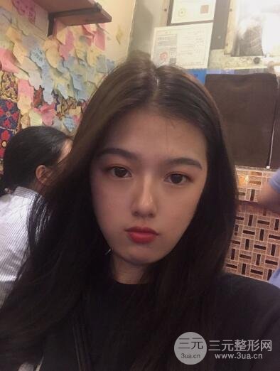 手术后4~7天