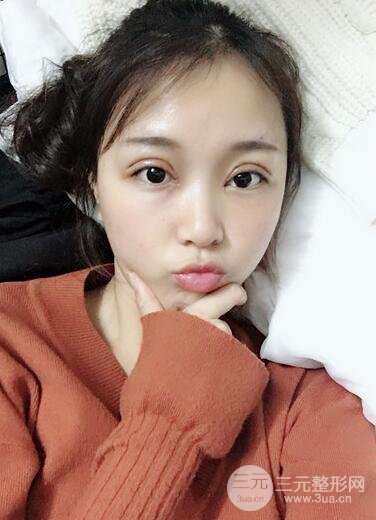手术过程中