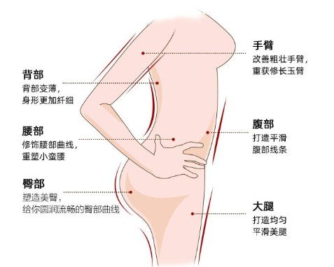 吸脂减肥术术后护理要点