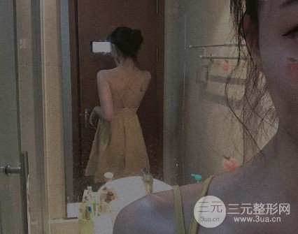 腰腹部吸脂手术经历