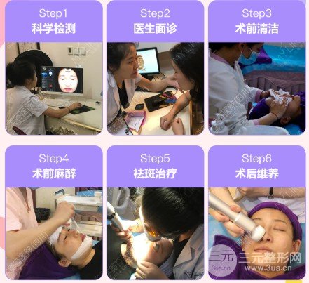 激光能治黄褐斑吗