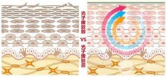 e光祛斑会反弹吗?祛斑反弹的原因及预防方法