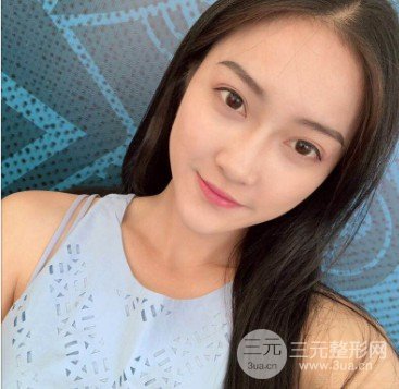 果酸换肤果真的好吗