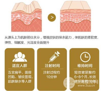 玻尿酸填充鼻唇沟成好吗