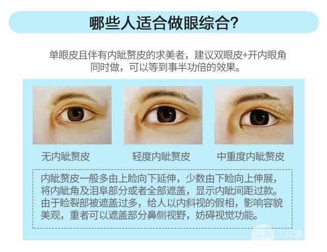 双眼皮多项整形多长时间能美妆