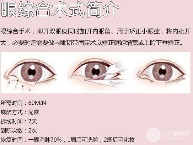 双眼皮多项整形多长时间能美妆