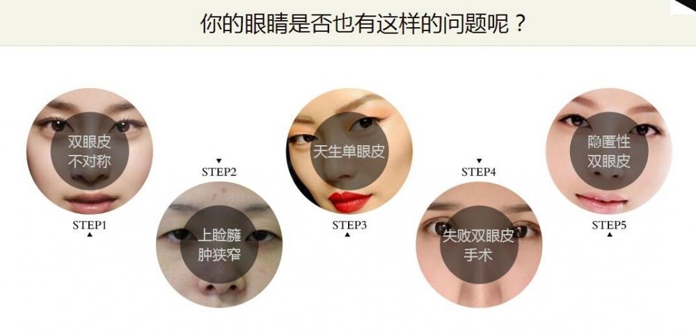 做完双眼皮多项整形多久可以恢复?