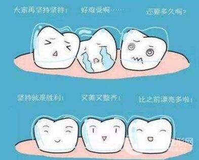 口腔正畸知识科普
