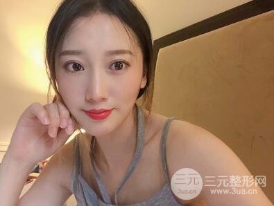 双眼埋线恢复七天图