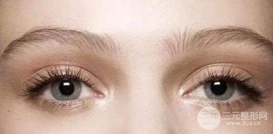 有必要同时做双眼皮和开眼角吗?