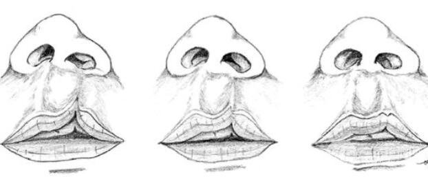 手术的好的时间