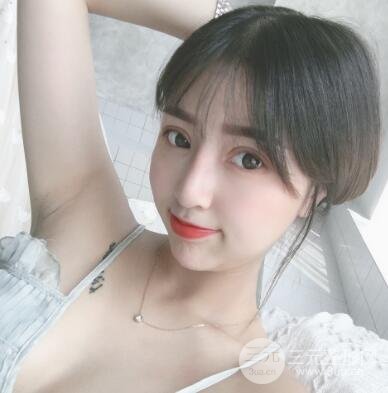 韩式3点式双眼皮案例