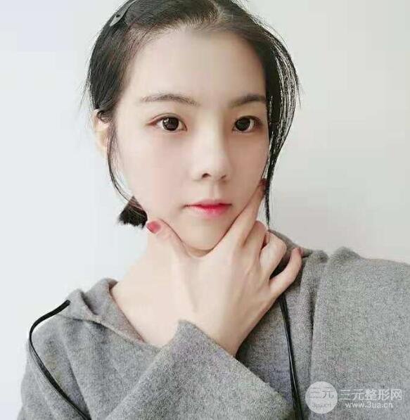 玻尿酸隆鼻过程