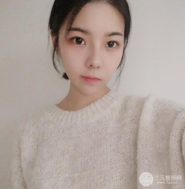 玻尿酸隆鼻过程