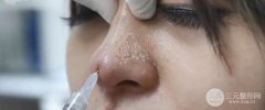 刚做完玻尿酸隆鼻图片真人果展示，玻尿酸的危害盘点！