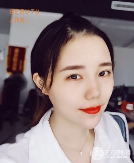术后护理