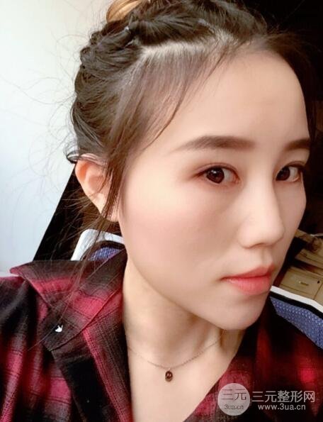 术后护理