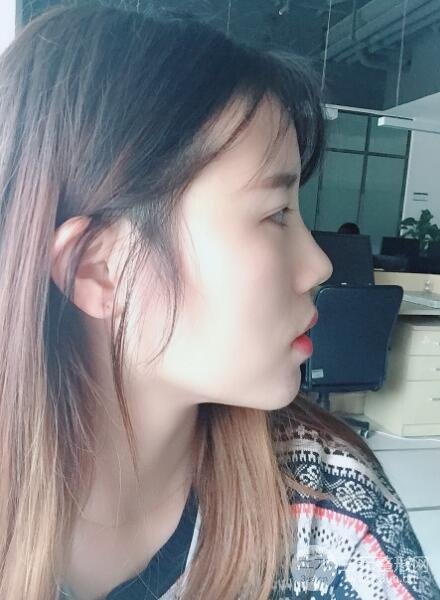 术后护理