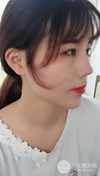 术后护理