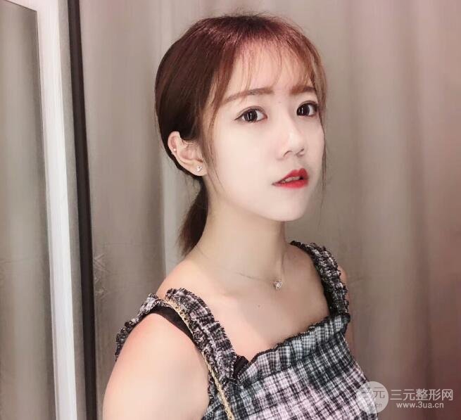 手术之后的肿泡眼不见了