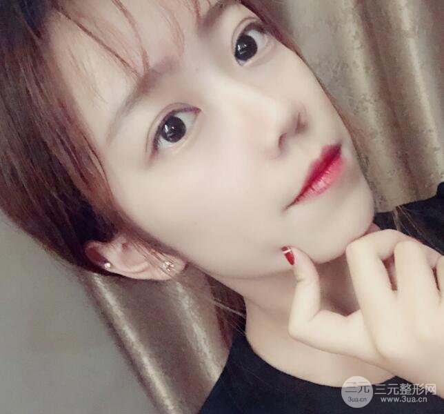 手术之后的肿泡眼不见了