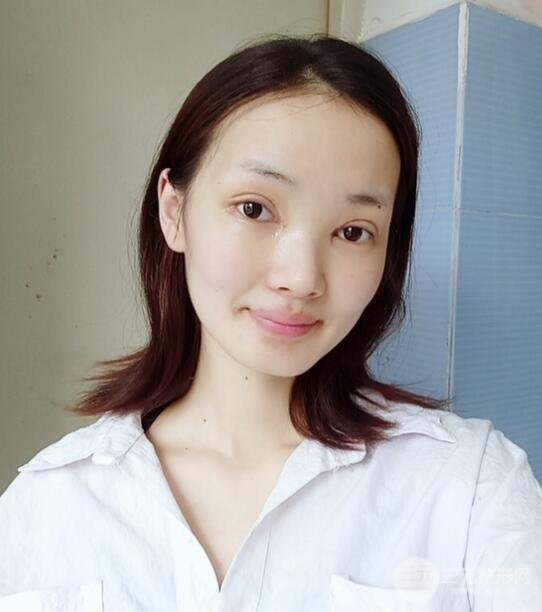 手术之后的那几天