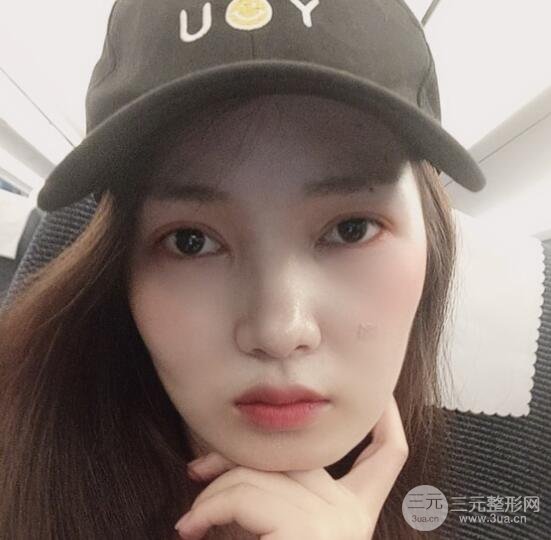 手术之后的那几天