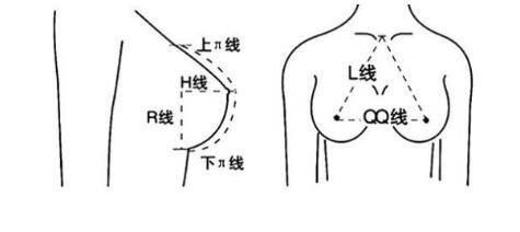 隆胸后注意事项