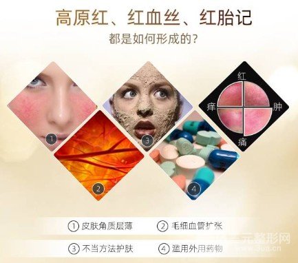 缓解红血丝多少钱
