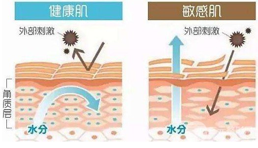 缓解红血丝多少钱