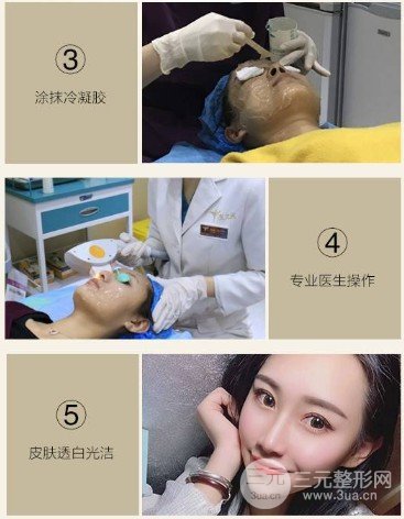 缓解红血丝多少钱