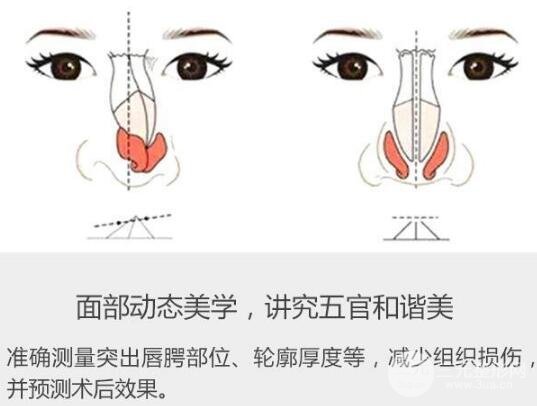 兔唇手术的步骤