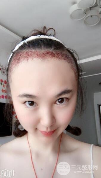 手术操作中