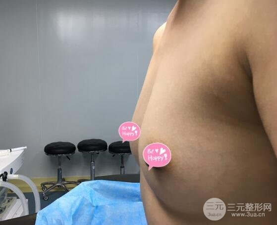 隆胸前平坦的我
