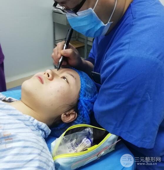 上海隆鼻案例参考