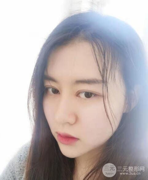 上海隆鼻案例参考