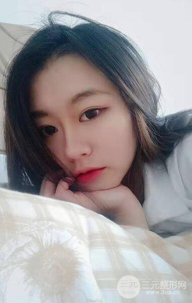 上海隆鼻案例参考