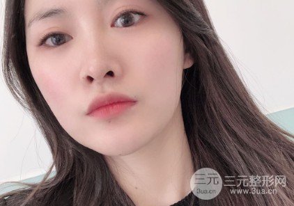 像素激光去痘印果
