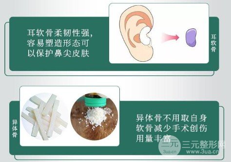 耳软骨垫鼻尖多久消肿