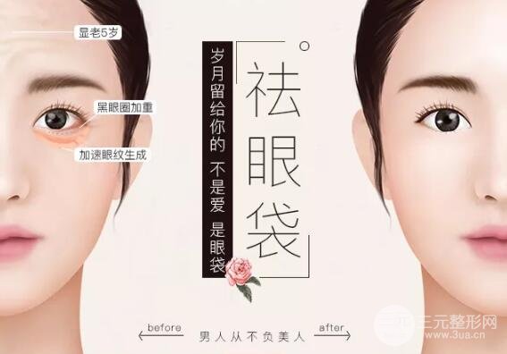 如何改良眼袋?