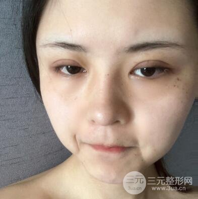 操作过程快