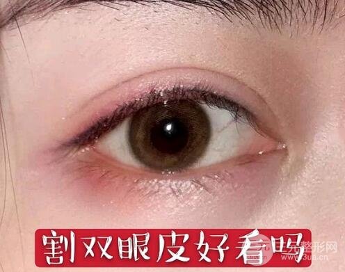 割双眼皮的风险有哪些?