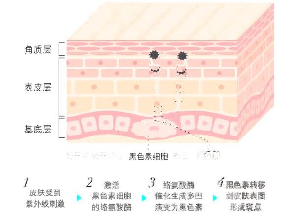 常见激光缓解肌肤问题解答