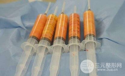 脂肪吸收率取决于这些因素