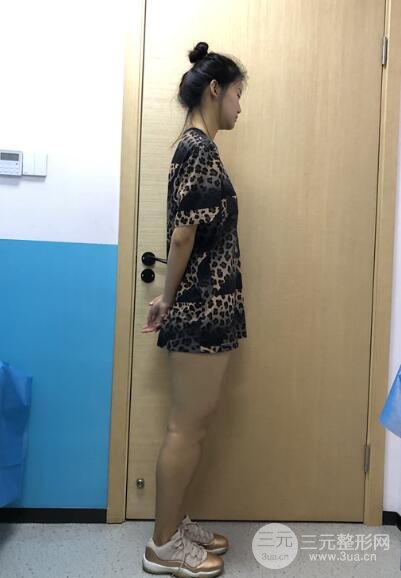 手术以后