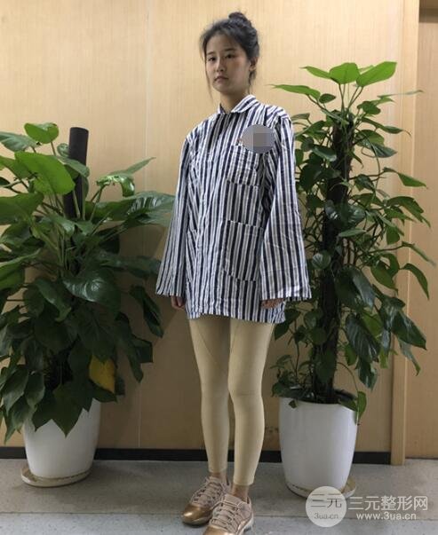 手术以后