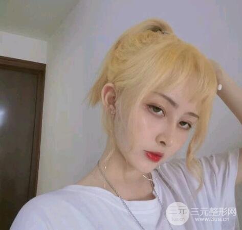 鼻头缩小手术后