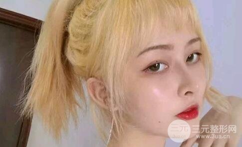 鼻头缩小手术后