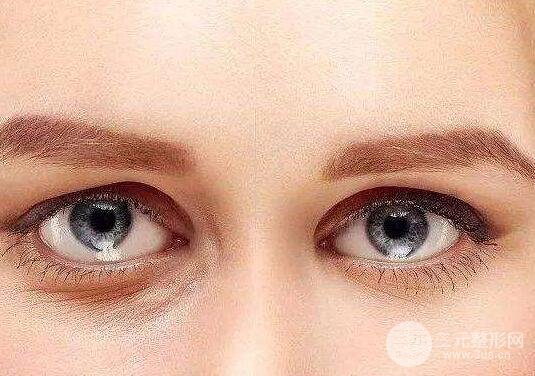 快速消除眼袋的小妙招
