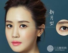 zui好看的四种双眼皮有哪些？你已拥有吗？